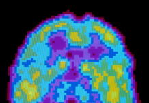 Según los científicos, dormimos para olvidar