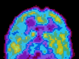 Según los científicos, dormimos para olvidar