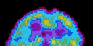Según los científicos, dormimos para olvidar