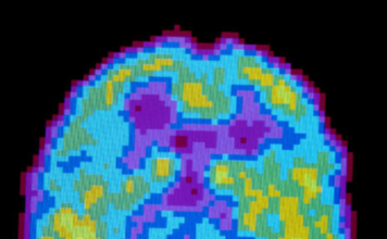 Según los científicos, dormimos para olvidar