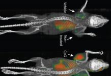 Una vacuna elimina tumores y sus metástasis ocultas en ratones