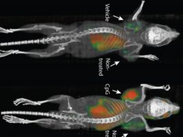 Una vacuna elimina tumores y sus metástasis ocultas en ratones