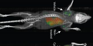 Una vacuna elimina tumores y sus metástasis ocultas en ratones