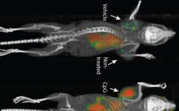 Una vacuna elimina tumores y sus metástasis ocultas en ratones