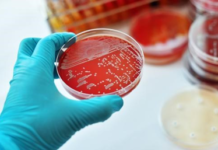 ¿Qué es la difteria?