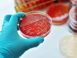 ¿Qué es la difteria?