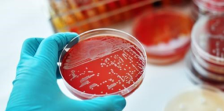 ¿Qué es la difteria?