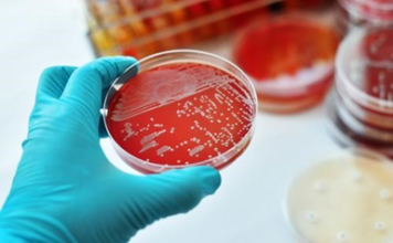 ¿Qué es la difteria?