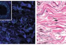 Intersticio, el «nuevo órgano» del cuerpo humano que la ciencia acaba de descubrir