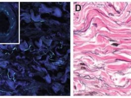 Intersticio, el «nuevo órgano» del cuerpo humano que la ciencia acaba de descubrir