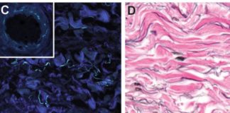 Intersticio, el «nuevo órgano» del cuerpo humano que la ciencia acaba de descubrir