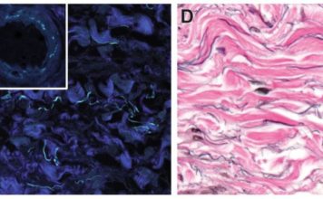 Intersticio, el «nuevo órgano» del cuerpo humano que la ciencia acaba de descubrir