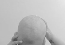 Juliana muestra foto de su cabeza si cabello por la quimioterapia