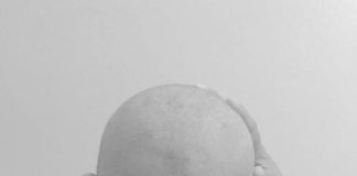 Juliana muestra foto de su cabeza si cabello por la quimioterapia