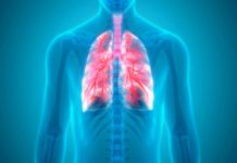 Mortal enfermedad “Legionario” amenaza cientos dominicanos