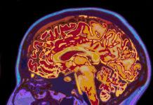 Investigan el autotrasplante de células madre en pacientes que han sufrido infartos