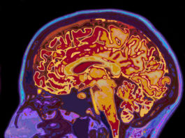 Investigan el autotrasplante de células madre en pacientes que han sufrido infartos