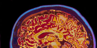 Investigan el autotrasplante de células madre en pacientes que han sufrido infartos