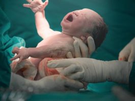 República Dominicana es líder mundial en cesáreas, según estudio