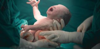 República Dominicana es líder mundial en cesáreas, según estudio