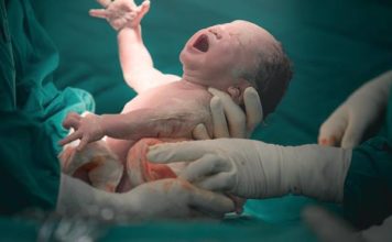 República Dominicana es líder mundial en cesáreas, según estudio