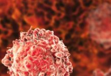 ¿Qué es la Leucemia?