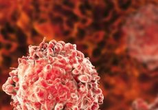 ¿Qué es la Leucemia?