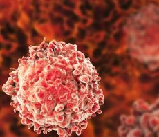 ¿Qué es la Leucemia?