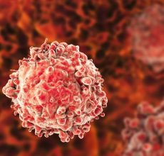 ¿Qué es la Leucemia?