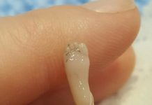 Sufre un aborto espontáneo y publica las desoladoras fotos de su bebé “perfectamente formado”