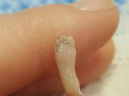 Sufre un aborto espontáneo y publica las desoladoras fotos de su bebé “perfectamente formado”