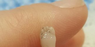 Sufre un aborto espontáneo y publica las desoladoras fotos de su bebé “perfectamente formado”