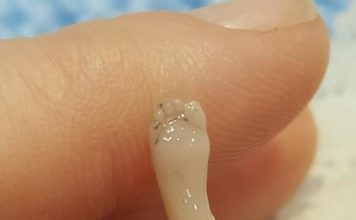 Sufre un aborto espontáneo y publica las desoladoras fotos de su bebé “perfectamente formado”