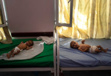 Calculan que 85.000 niños podrían haber muerto de hambre en Yemen