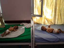 Calculan que 85.000 niños podrían haber muerto de hambre en Yemen