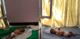 Calculan que 85.000 niños podrían haber muerto de hambre en Yemen