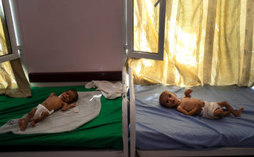 Calculan que 85.000 niños podrían haber muerto de hambre en Yemen