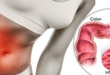 ¿Padeces de Colon Irritable? Aquí algunos consejos