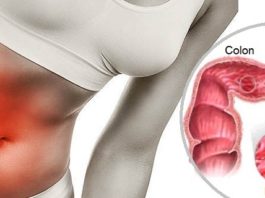 ¿Padeces de Colon Irritable? Aquí algunos consejos