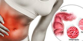 ¿Padeces de Colon Irritable? Aquí algunos consejos