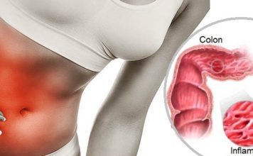 ¿Padeces de Colon Irritable? Aquí algunos consejos