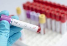 Células madre para tratar el VIH: el último gran avance contra el virus que causa el sida