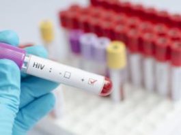 Células madre para tratar el VIH: el último gran avance contra el virus que causa el sida