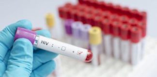 Células madre para tratar el VIH: el último gran avance contra el virus que causa el sida