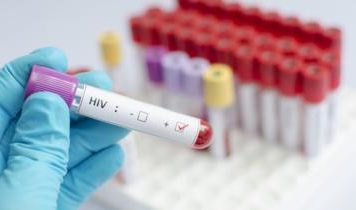 Células madre para tratar el VIH: el último gran avance contra el virus que causa el sida