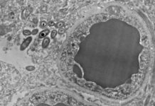 ¿Por qué hay bacterias intestinales dentro del cerebro humano?