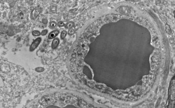 ¿Por qué hay bacterias intestinales dentro del cerebro humano?