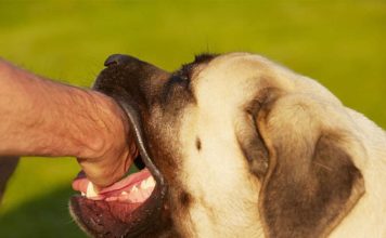 Hospital Robert Reid Cabral lamenta muerte de menor diagnosticado con rabia humana
