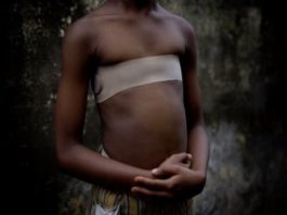 Qué es el planchado de senos que algunas madres utilizan para evitar que los hombres se acerquen a sus hijas