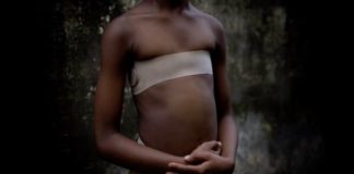 Qué es el planchado de senos que algunas madres utilizan para evitar que los hombres se acerquen a sus hijas